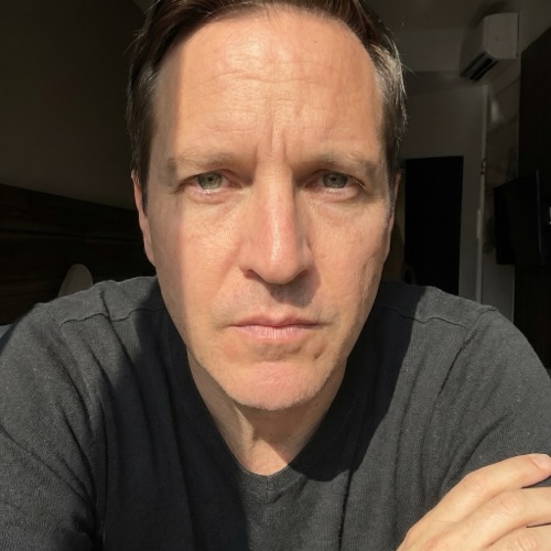 DermLens AI before-and-after — user 5, before photo showing skin condition prior to personalised routine